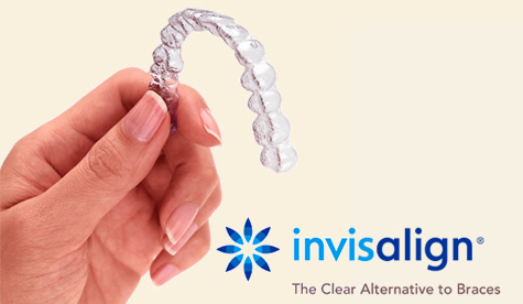 Invisalign